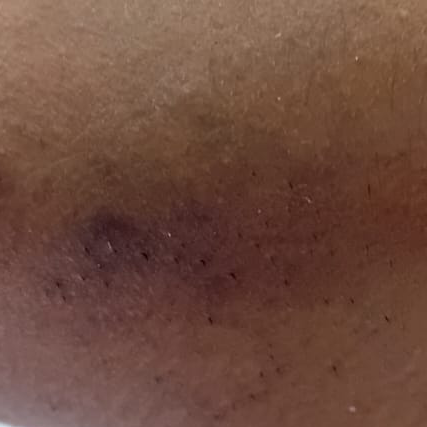 Vibha skin