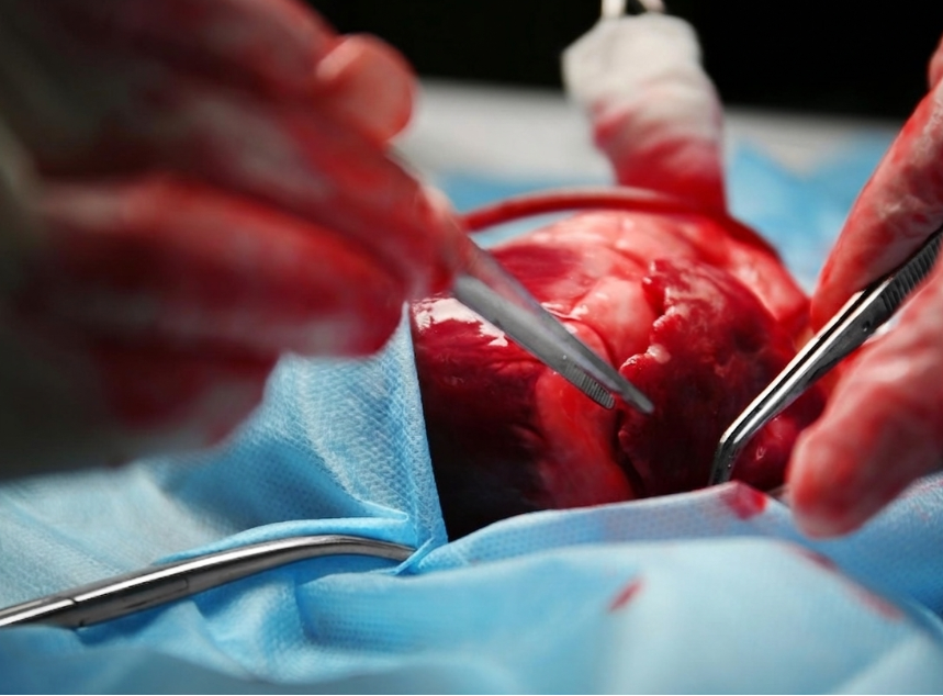 Small Incision Cardiac Surgery in Nagpur What Patients Should Know Before Choosing It