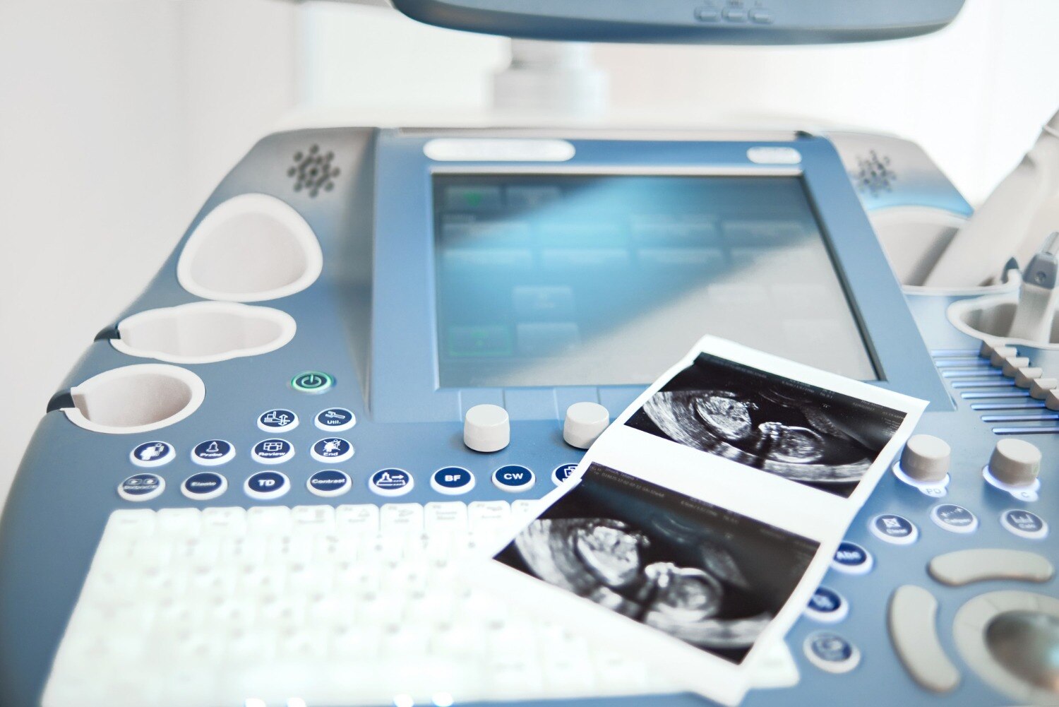 Which Ultrasound Scan Is Right for Fertility Care in Mumbai