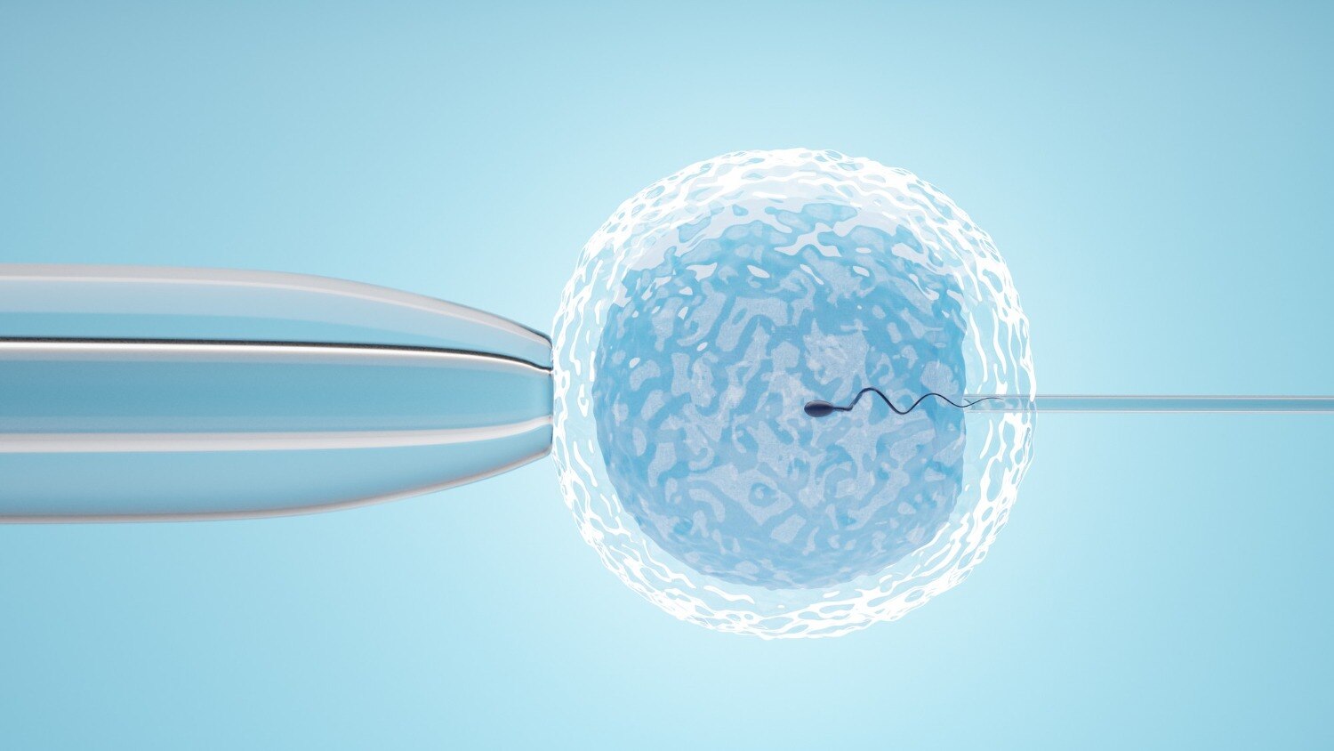 What Happens During ICSI from Egg Collection to Embryo Transfer in Mumbai