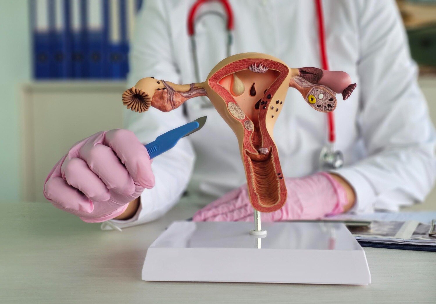 Choosing Between Uterus Removal Surgery Options in Mumbai
