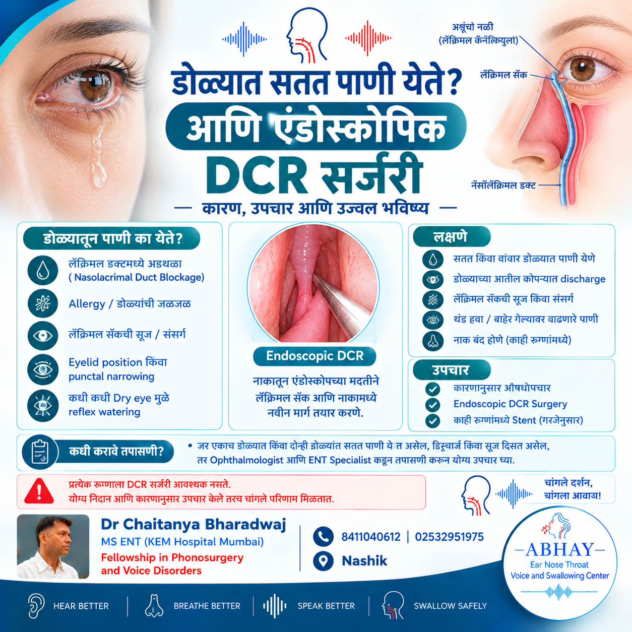 डोळ्यात सतत पाणी का येते? Endoscopic DCR Surgery | Nashik