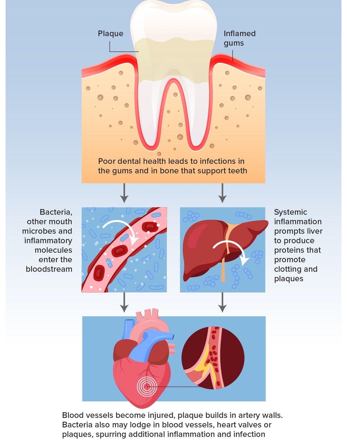 Gum Disease and Heart Health