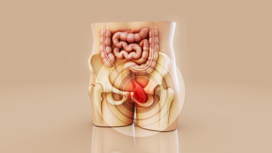 What to Expect from Fistula in Ano Surgery in Mumbai