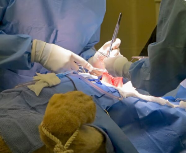 Is Rectal Prolapse Surgery Worth Considering in Mumbai