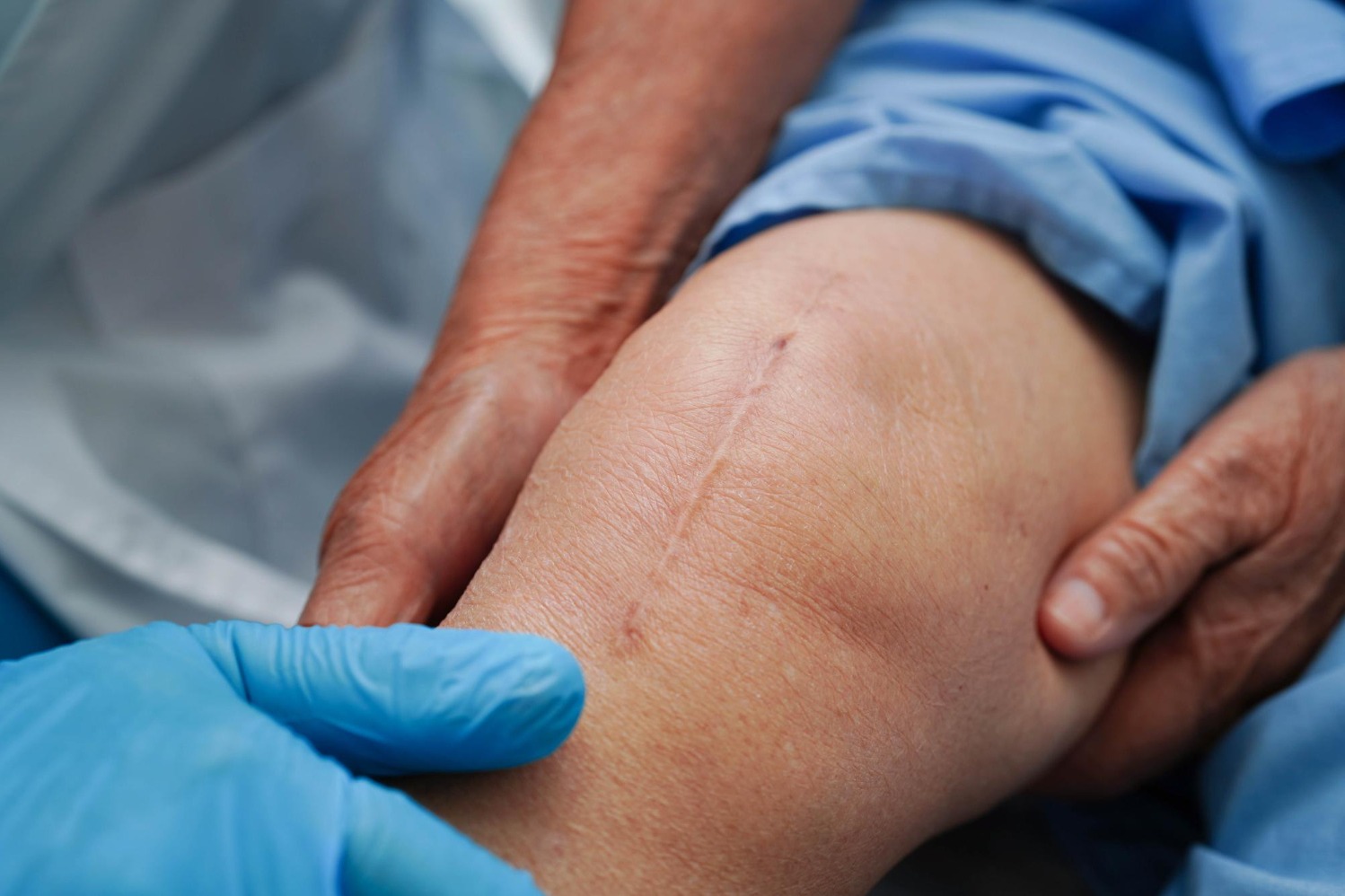 How to Assess High Success Rate Knee Surgery Claims Before Choosing Treatment