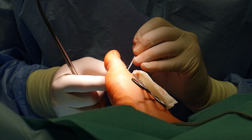 Diabetic Foot Surgery in Mumbai Comparing Treatment Options and Benefits