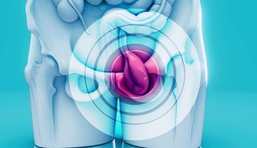 Laser Fistula Treatment Cost and Specialist near Parel