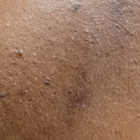 Vibha skin