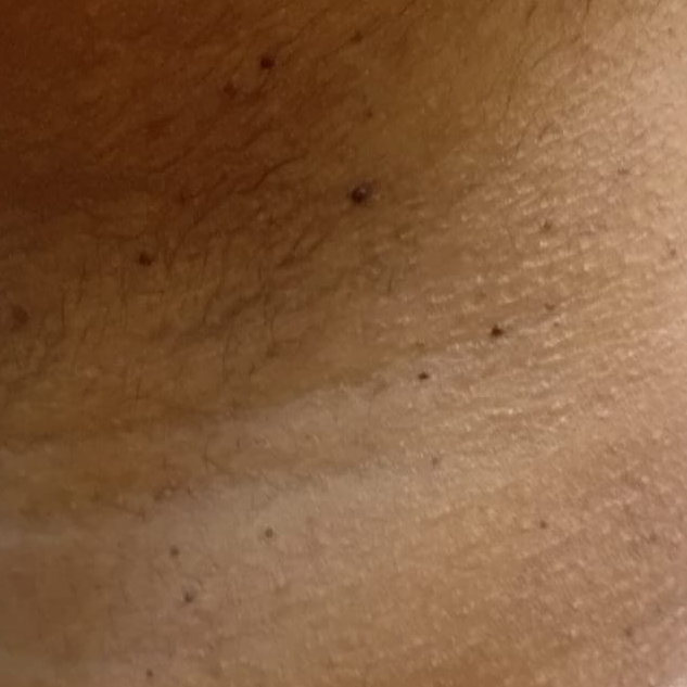 Vibha skin