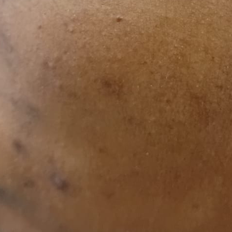 Vibha skin