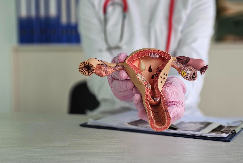 Myomectomy Surgery: Choosing a Uterus-Preserving Treatment for Fibroids