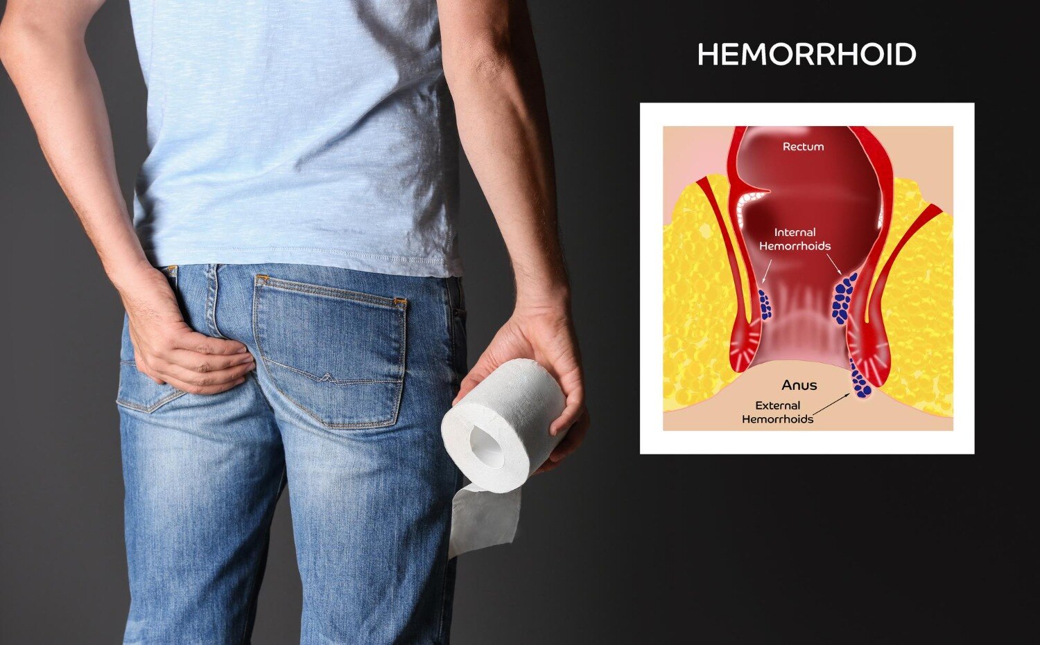 Is Laser Piles Surgery Worth It for Persistent Bleeding in Mumbai