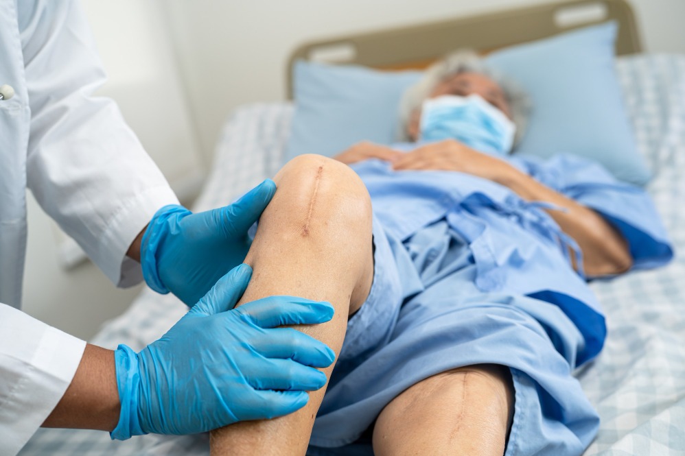 Best Knee Replacement Surgery: A Patient Checklist Before Choosing Treatment