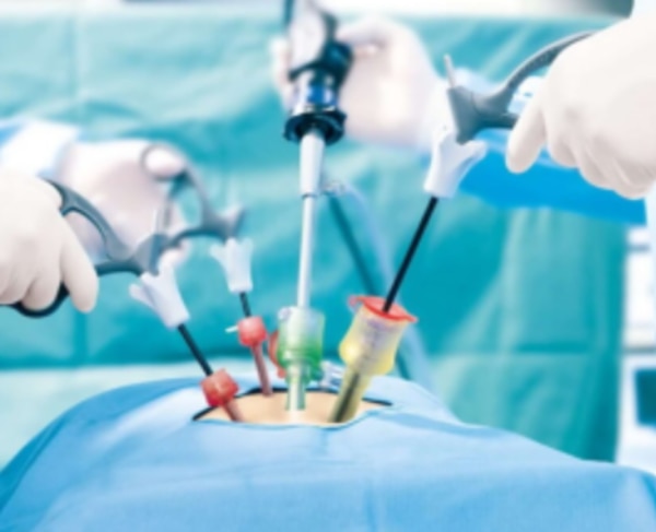 Laparoscopic Cholecystectomy When Is Gallbladder Removal Surgery Necessary for Gallstones?