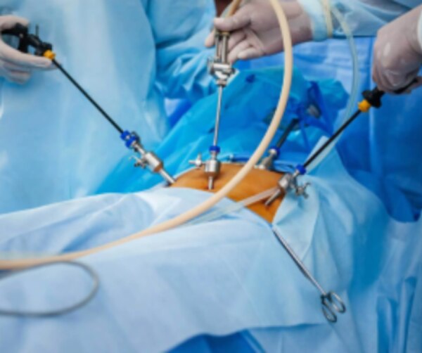 Laparoscopic Ovarian Cyst Removal Understanding Treatment Options for Persistent Ovarian Cysts