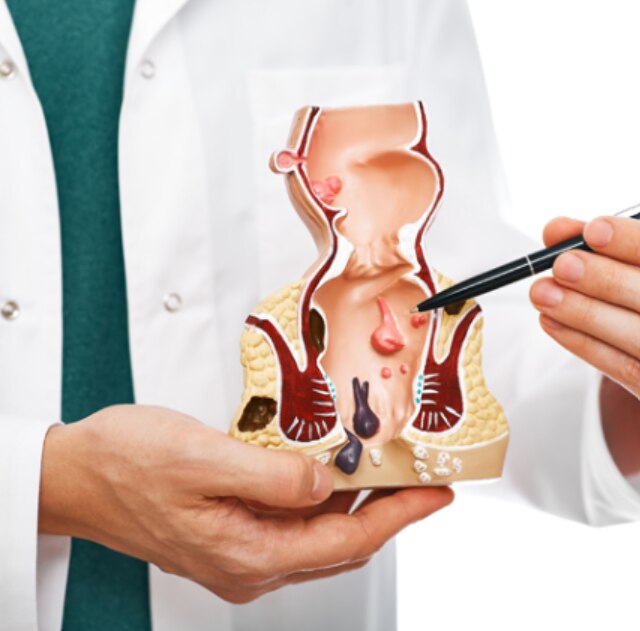 Fissure Treatment Understanding Anal Fissure Symptoms, Causes and Available Treatments