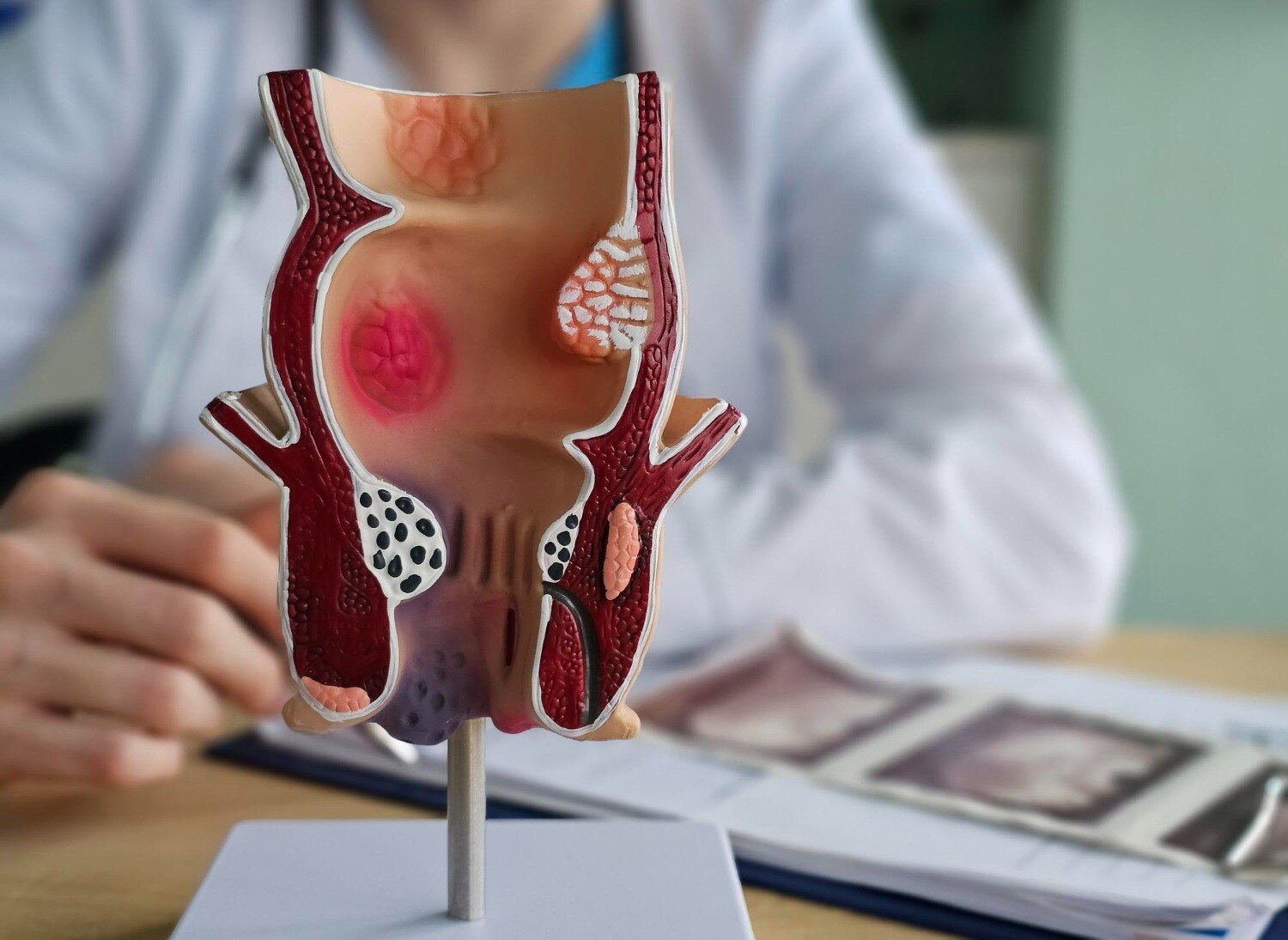 When Should You Visit a Piles Clinic Instead of Managing Symptoms at Home?