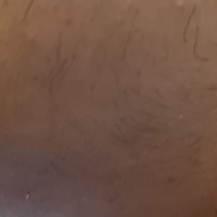 Vibha skin