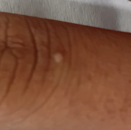 Vibha skin