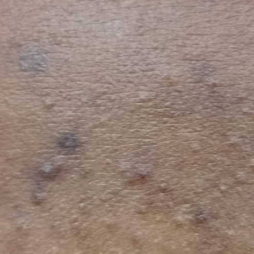 Vibha skin
