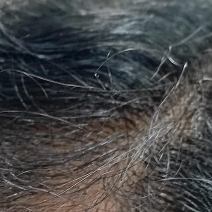 Vibha skin