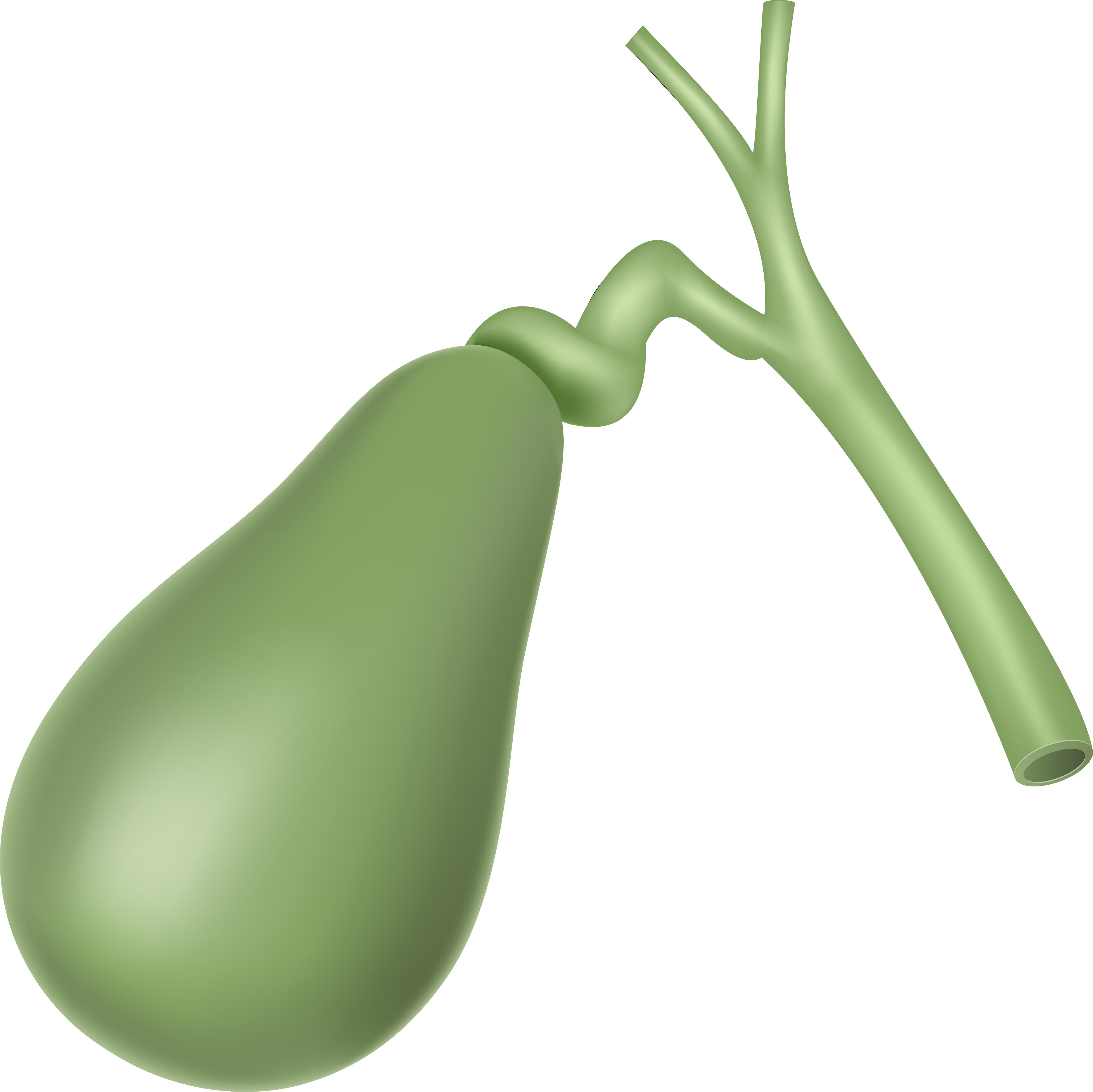 Understanding Gall Bladder Surgery and When Surgical Removal Becomes Necessary