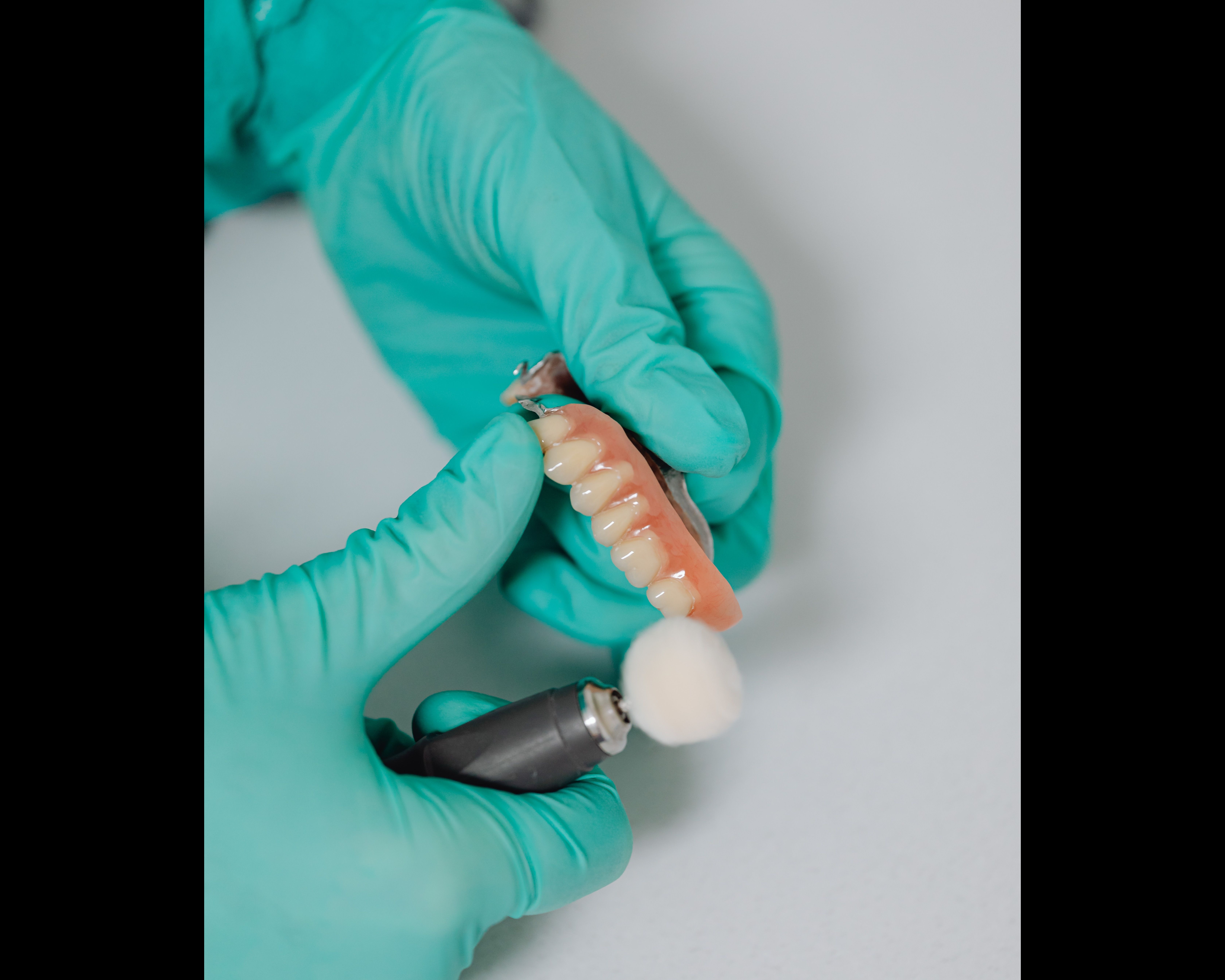 Affordable Dentures Near Me In Fort Mumbai