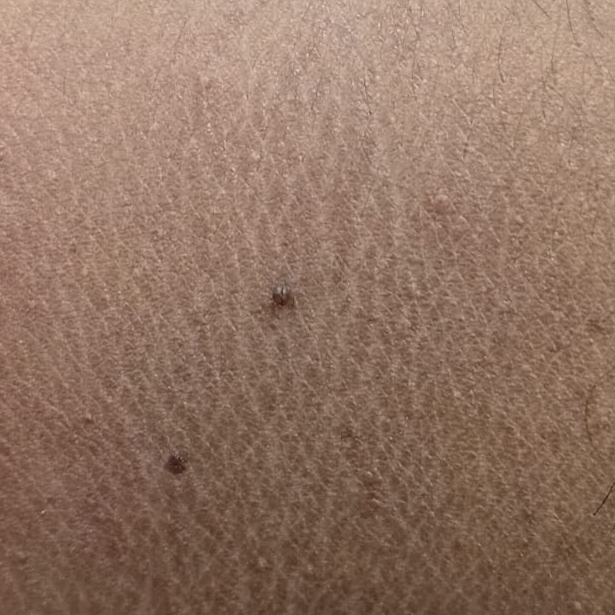 Vibha skin