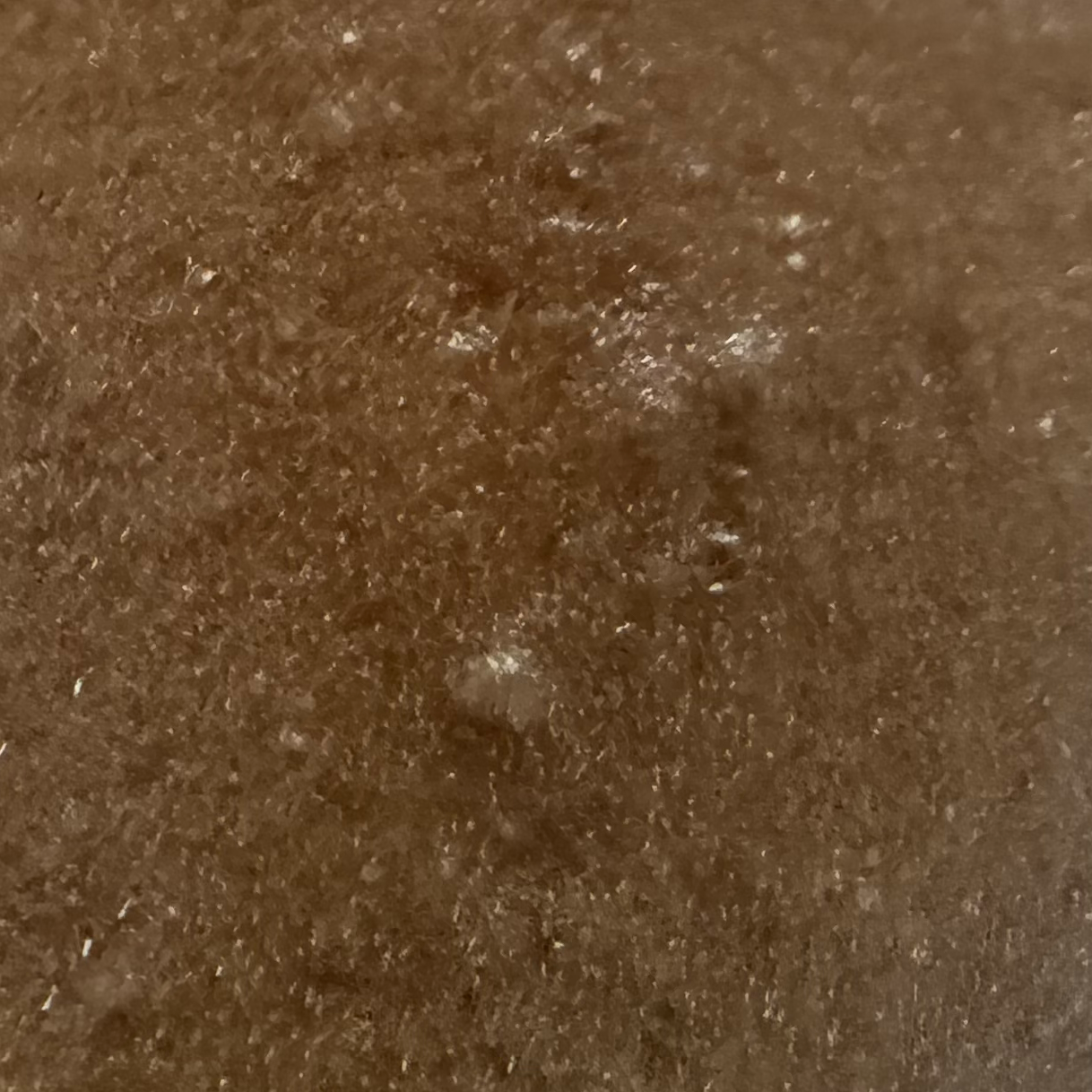 Vibha skin