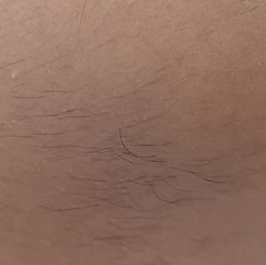 Vibha skin