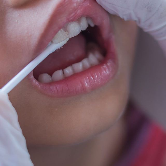 Protecting Young Smiles from Cavities