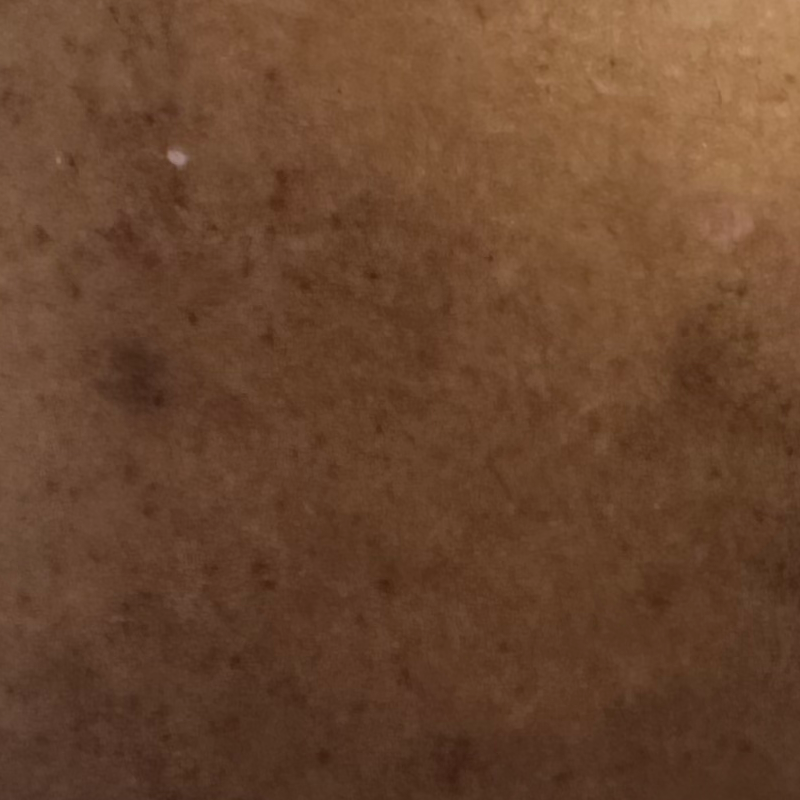 Vibha skin
