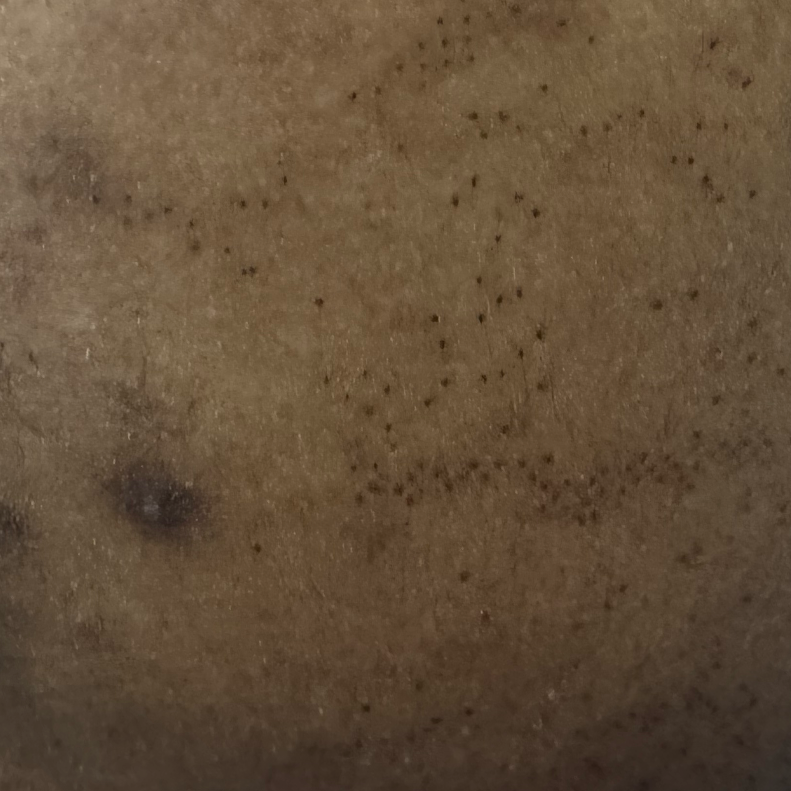 Vibha skin