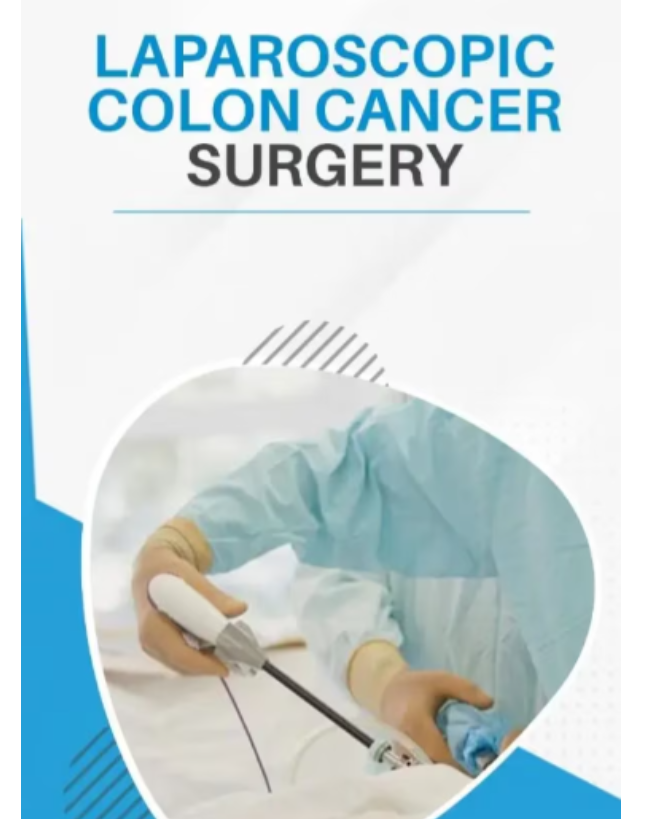 Laparoscopic GI Surgery in Palava When Is Minimally Invasive Surgery Appropriate