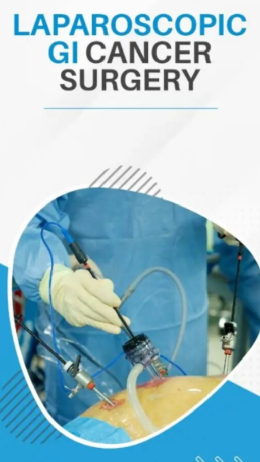 Laparoscopic GI Cancer Surgery in Dombivli West What Patients Should Understand Before Treatment