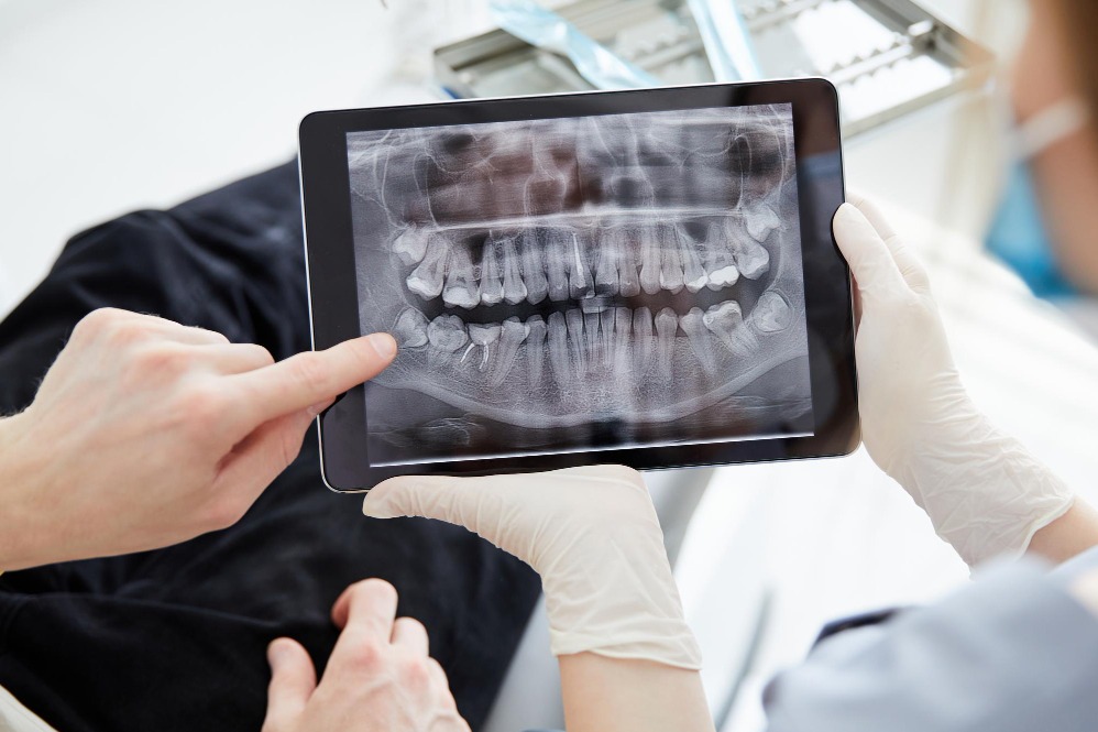 Digital Dental X-Ray in Diva Thane: Why Imaging Can Be Important Before Dental Treatment