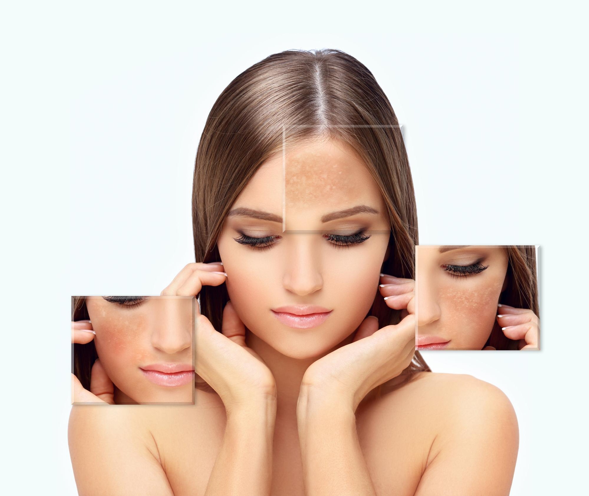 Pigmentation Treatment in Sanghvi What to Check Before Choosing a Skin Clinic
