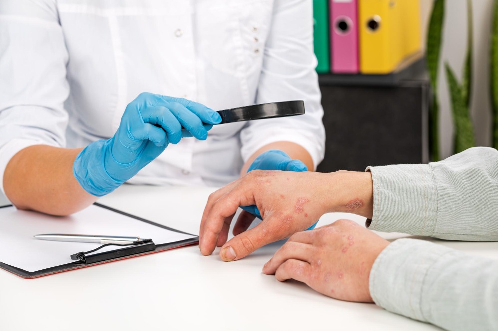 Skin Allergy Treatment in Borivali Starts by Identifying the Trigger