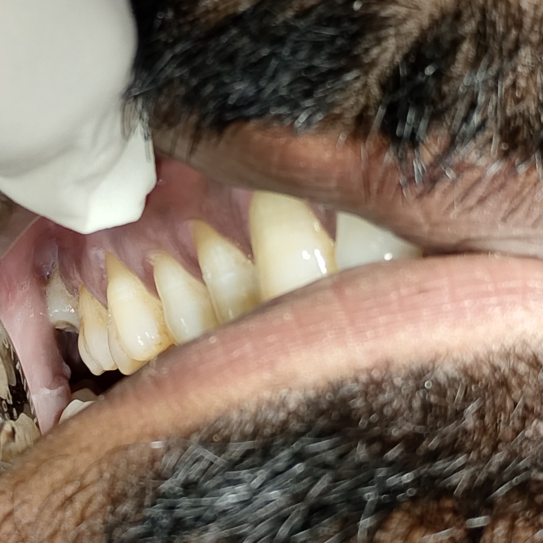 Can Receding Gums Grow Back on Their Own? Advice from Dr. Nandini at Align & Smile Dental Care