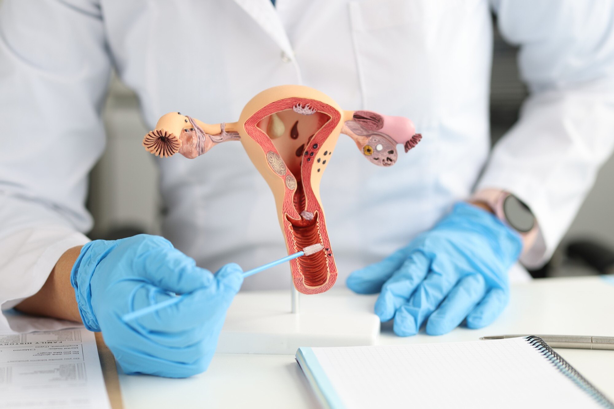 IUI Treatment Who May Benefit From IUI Treatment and What Happens During the Procedure