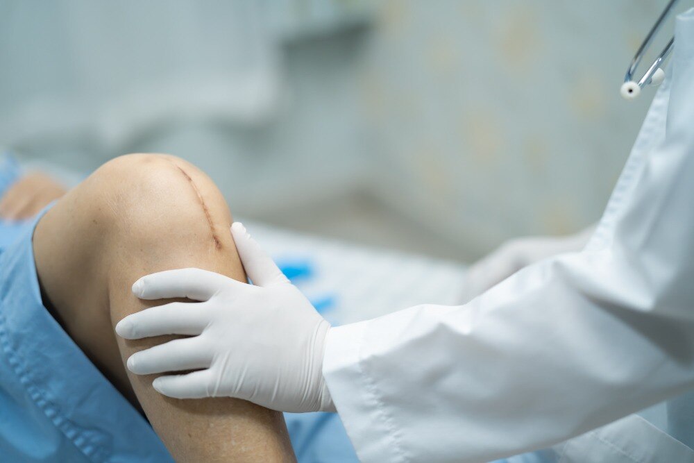 When Joint Replacement Surgery May Be Considered for Severe Joint Damage