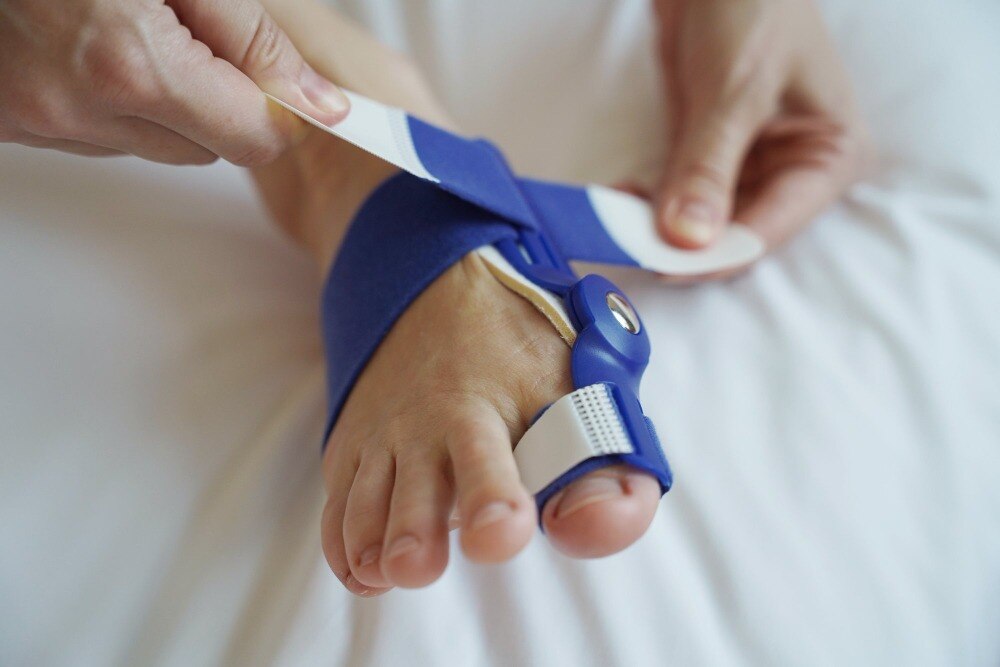 Why Early Clubfoot Treatment Is Important for a Child’s Foot Development