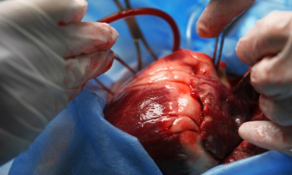 Valve Surgery in Nagpur Signs It May Be Time for a Surgical Consultation
