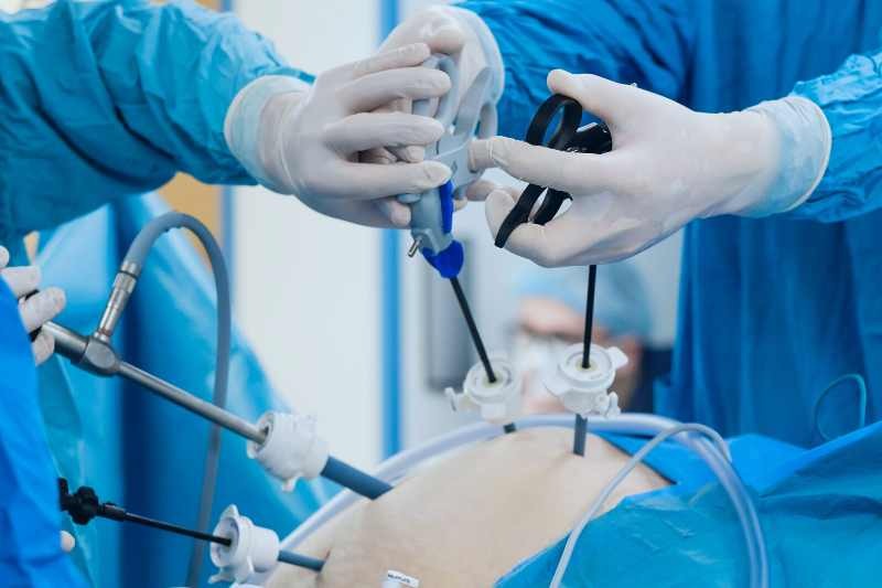 How Endoscopic Surgery Benefits Patients in Pune