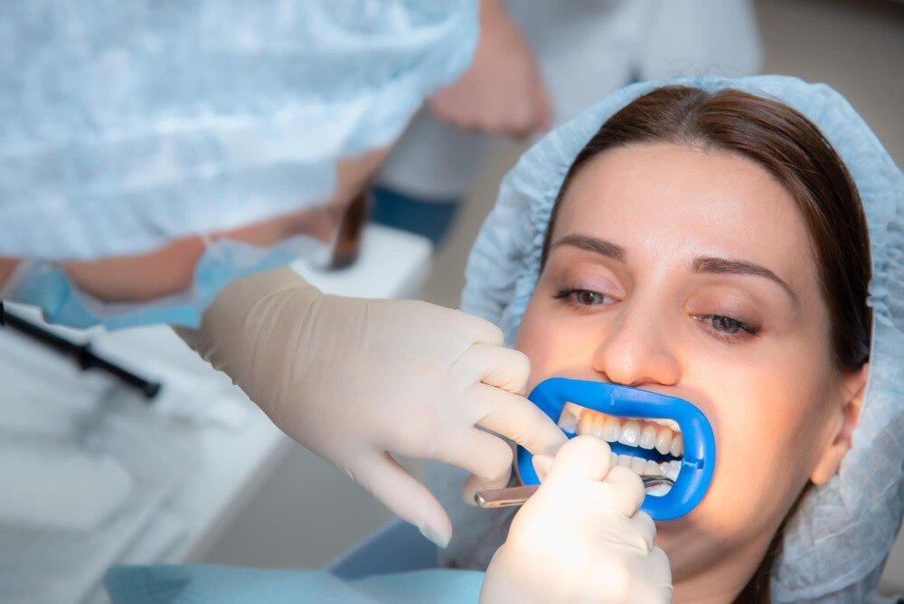 What Does Full Mouth Rehabilitation Include for Multiple Dental Problems?