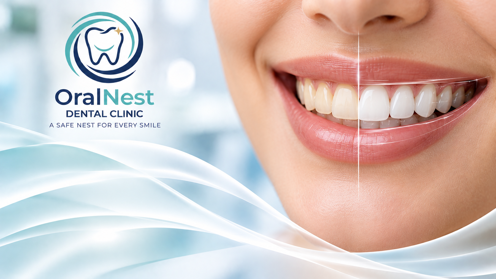 Teeth Cleaning Cost Near Pimple Gurav, Pune: What Does Dental Scaling at ₹999 Include?