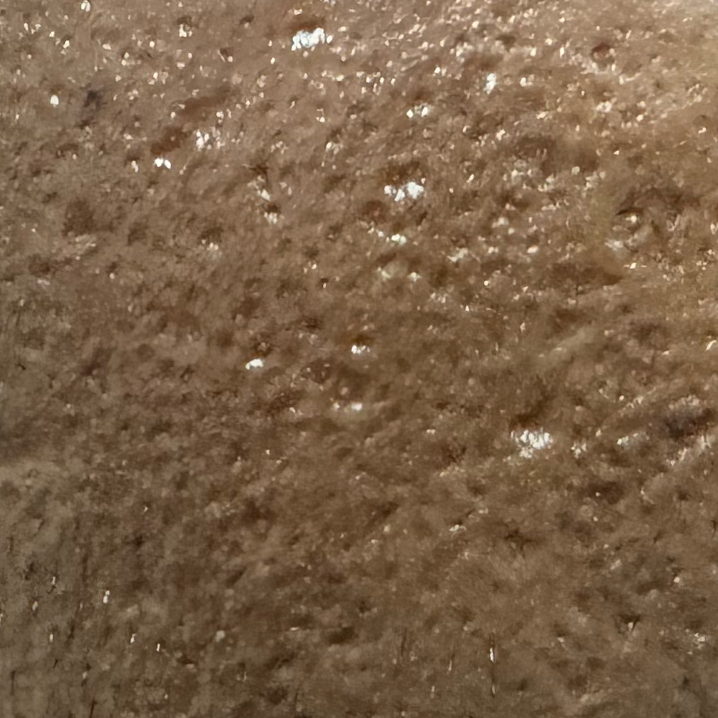 Vibha skin