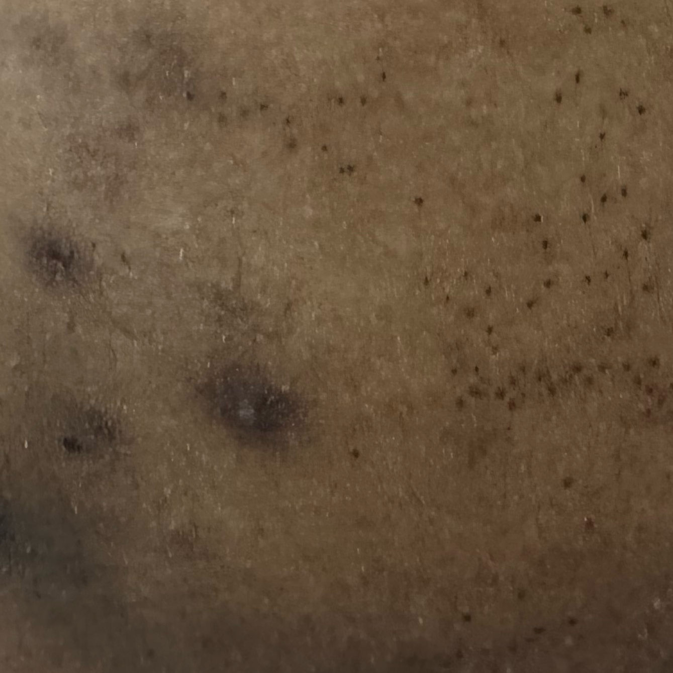 Vibha skin