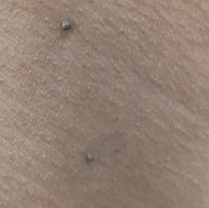 Vibha skin